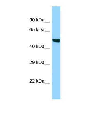 ACSBG1 / hsBG Antibody (aa509-558)