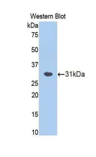 FSCN1 / Fascin Antibody (aa8-260, PE)