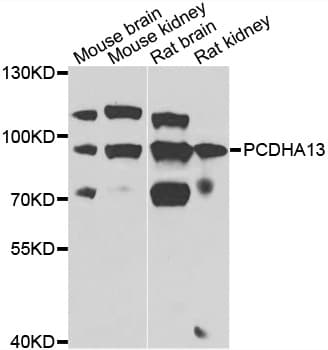 Polyclonal Rabbit anti-Human PCDHA13 Antibody (IHC, WB)