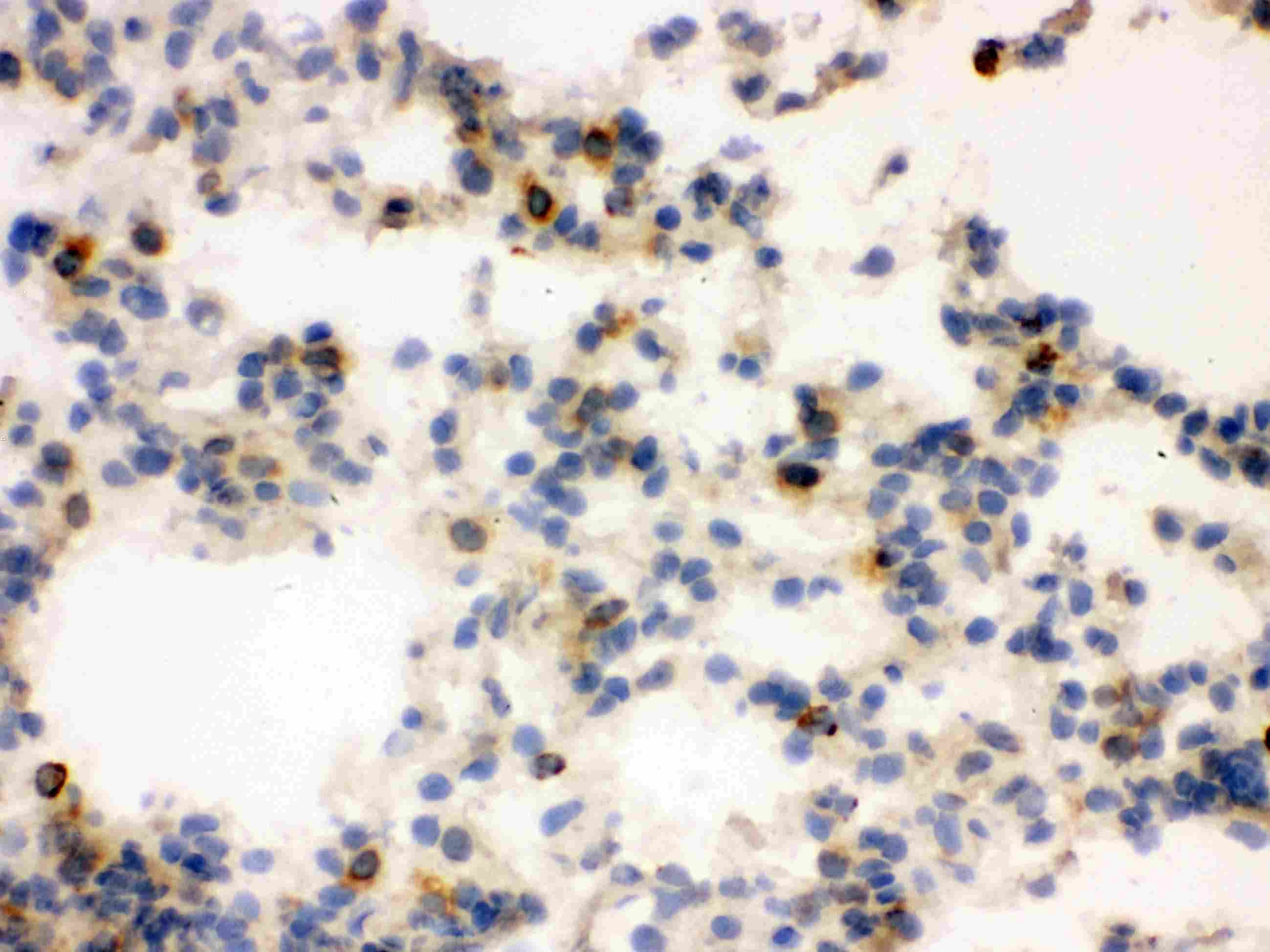 LCN2 / Lipocalin 2 / NGAL Antibody (aa21-200)