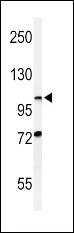 Polyclonal Rabbit anti-Human HIF1A / HIF1 Alpha Antibody (aa1-30, IHC, IF, WB)