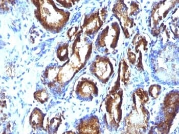 KLK3 / PSA Antibody (clone KLK3/801 + KLK3/1248)