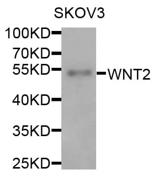 WNT2 / IRP Antibody