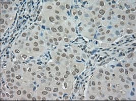 SATB1 Antibody (clone OTI13D6)
