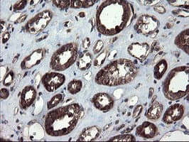 SKIL / SNO / SnoN Antibody (clone OTI3E9)