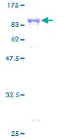 Human YARS / Tyrosyl-tRNA Synthetase Protein (Recombinant GST)