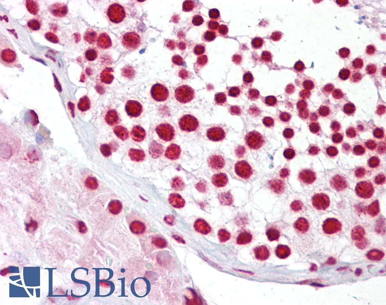 IHC-plus™ Polyclonal Rabbit anti-Human SIRT7 / Sirtuin 7 Antibody (aa331-360, IHC, WB)