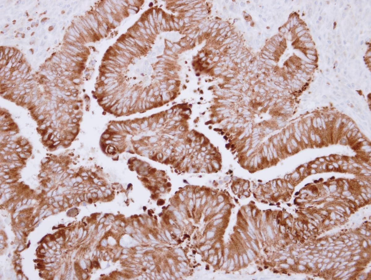 CES2 / Esterase Antibody