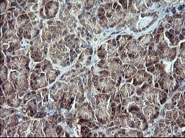 TP73 / p73 Antibody (clone OTI2H2)