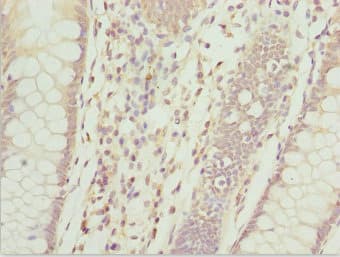 ZFAND3 / TEX27 Antibody