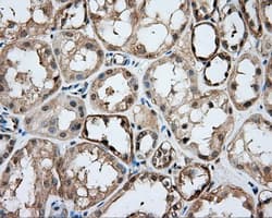 DNTTIP1 / TDIF1 Antibody (clone OTI1E2)