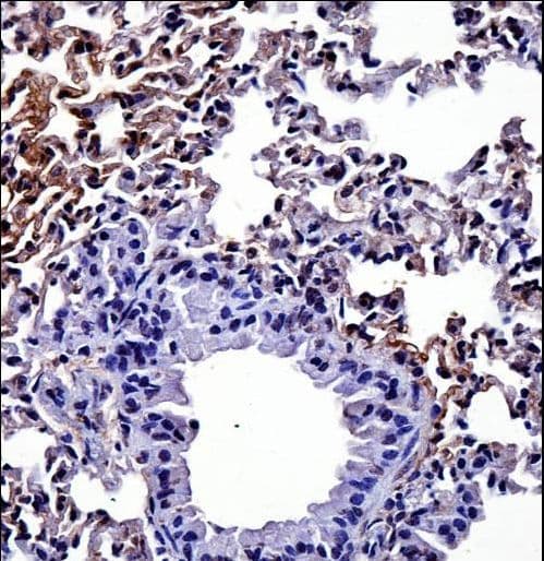 HIPK4 Antibody (aa533-562)