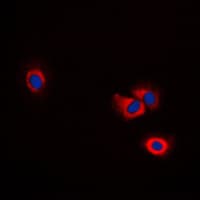 Polyclonal Rabbit anti-Human ARTS1 / ERAP1 Antibody (Internal, IHC, IF, WB)
