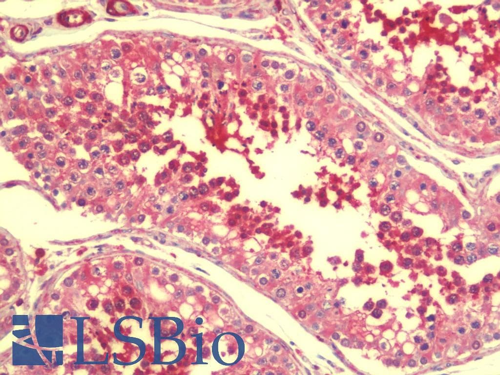 IHC-plus™ Polyclonal Chicken anti-Human SPATA19 Antibody (IHC, WB)
