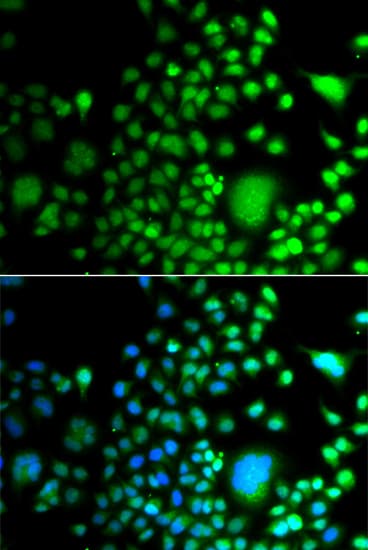 Polyclonal Rabbit anti-Human PAX6 Antibody (IHC, IF, WB)