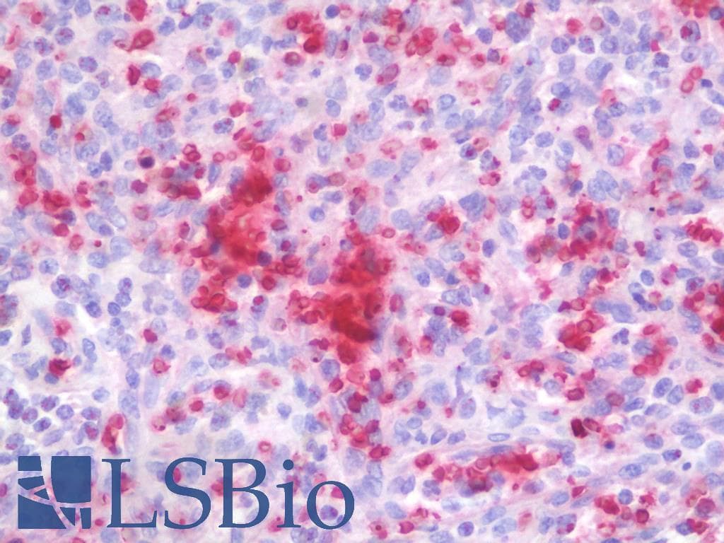 IHC-plus™ TGFB1 / TGF Beta 1 Antibody