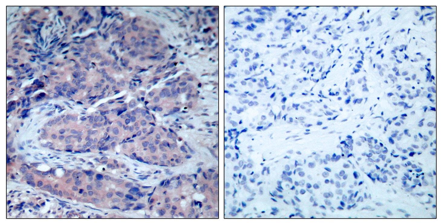 MAP2K4 / MKK4 Antibody (p261)