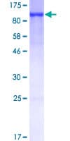 Human EZR / Ezrin Protein (Recombinant GST)