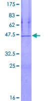Human RARRES2 / Chemerin Protein (Recombinant GST)