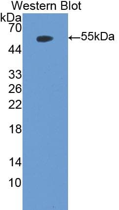 MPO / Myeloperoxidase Antibody (aa253-718)