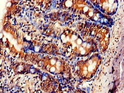 Polyclonal Rabbit anti-Human F2RL1 / PAR2 Antibody (IHC, IF)