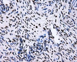 Monoclonal Mouse anti-Human RIP1 / RALBP1 Antibody (clone OTI11B2, IHC, IF, WB)