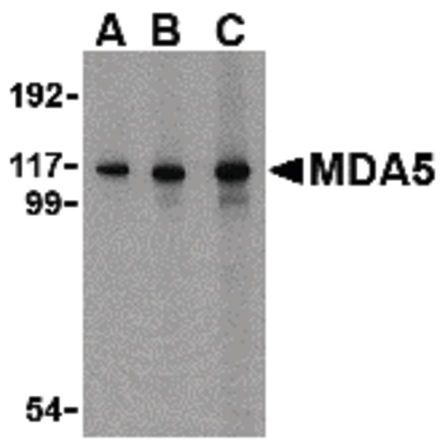 IHC-plus™ IFIH1 / MDA5 Antibody