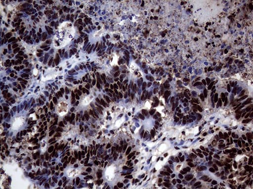 Monoclonal Mouse anti-Human TALDO1 / Transaldolase 1 Antibody (clone OTI1E5, IHC, WB)