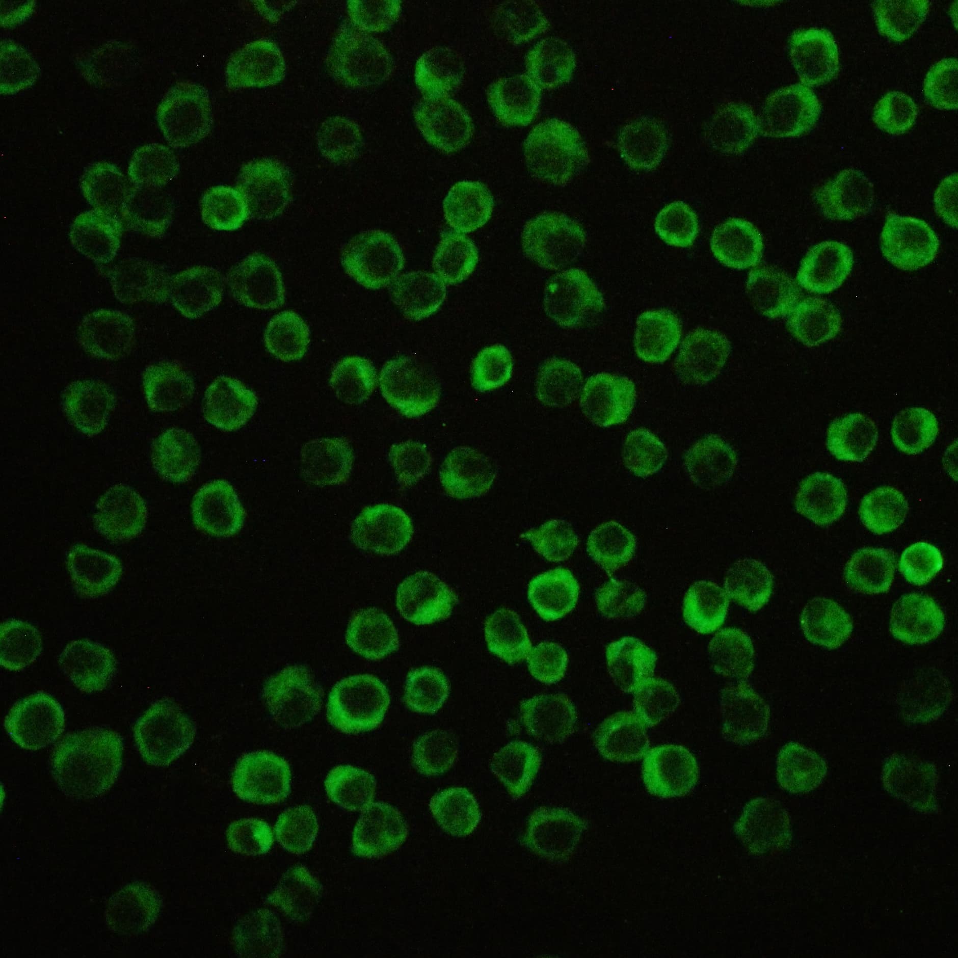 NALP3 / NLRP3 Antibody (aa12-31)