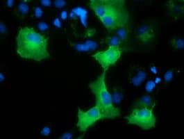 AK5 / Adenylate Kinase 5 Antibody (clone OTI2D3)