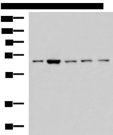 CHEK2 / CHK2 Antibody