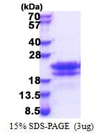 Human CEND1 Protein (Recombinant His)