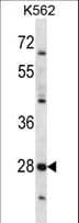 PRSS27 / CAPH2 Antibody (aa182-211)