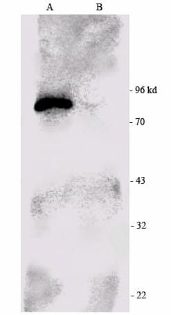 Polyclonal Rabbit anti-Human RPS6KA1 / RSK1 Antibody (C-Terminus, WB)