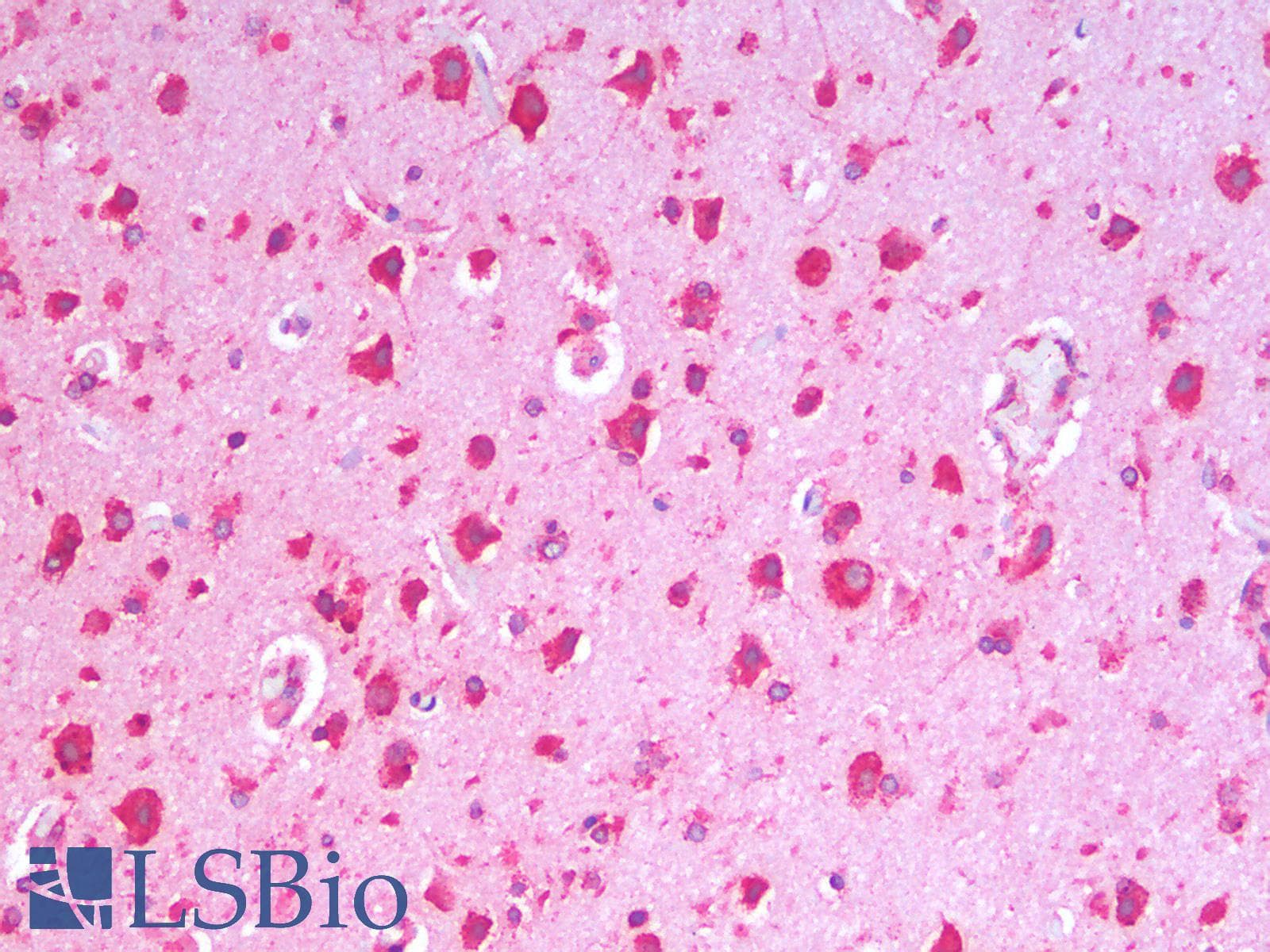 IHC-plus™ HSPA5 / GRP78 / BiP Antibody