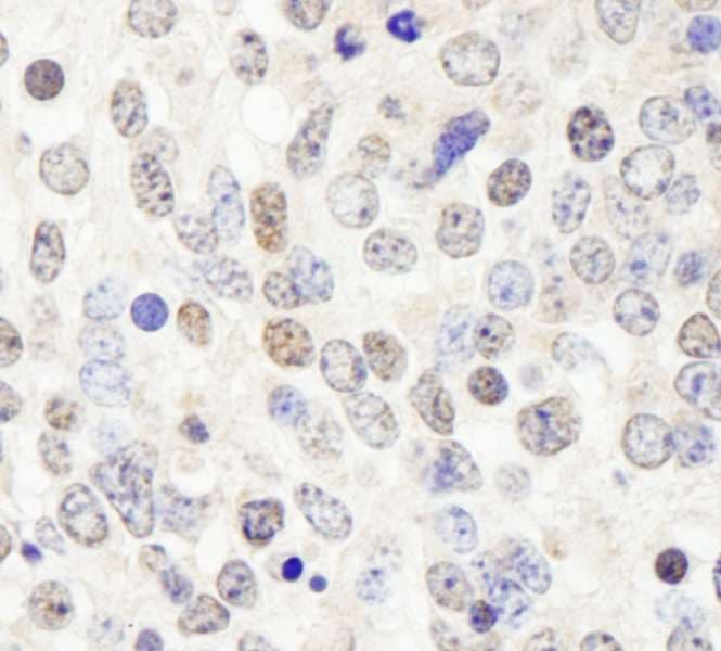 HDAC7 Antibody (aa902-952)