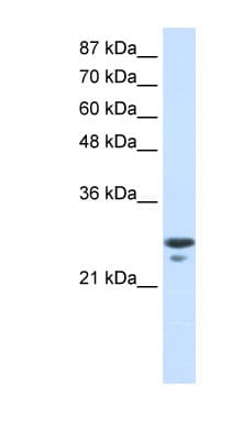 MtTFA / TFAM Antibody (aa75-124)