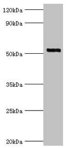 IRAK4 / IRAK-4 Antibody (aa1-220)