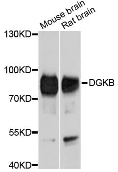 DGKB / DGK Beta Antibody