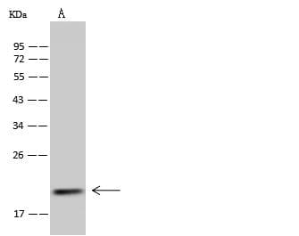 MRPS25 Antibody