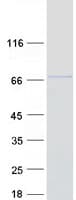 Human TRIM26 Protein (Recombinant Myc-DDK (Flag))