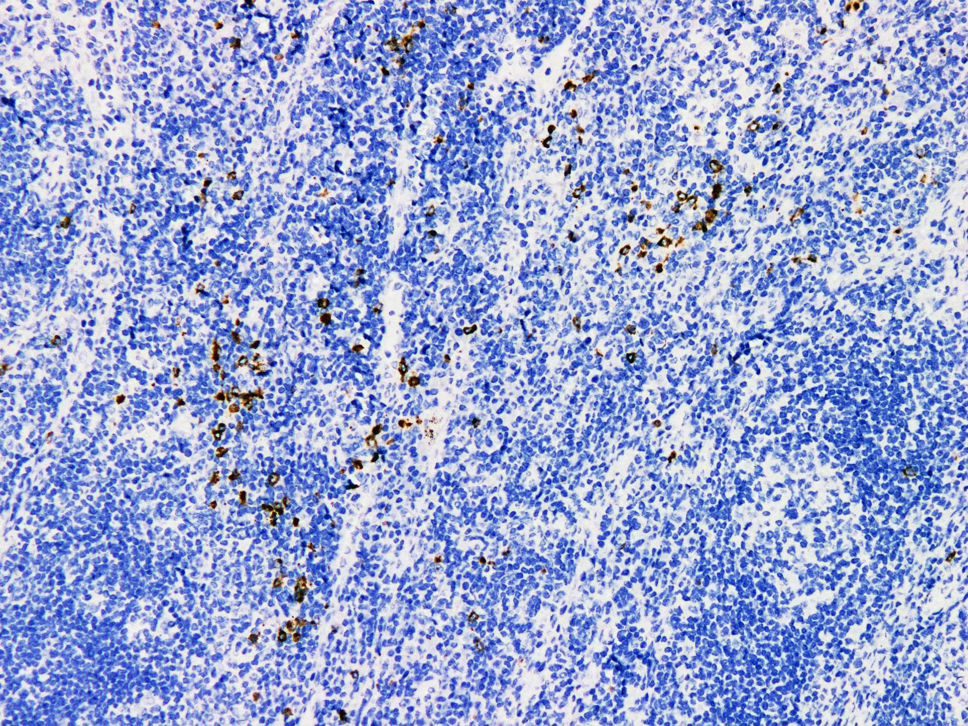 GZMB / Granzyme B Antibody
