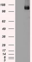 TRPM4 Antibody (clone OTI10H5)