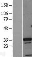 Human CDX4 Protein (Over-Expression Lysate Myc-DDK (Flag))
