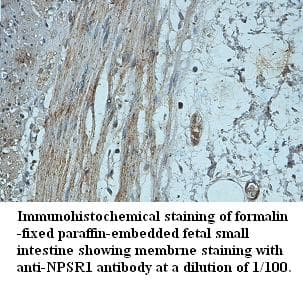 NPSR1 / NPSR / GPR154 Antibody (aa241-300)