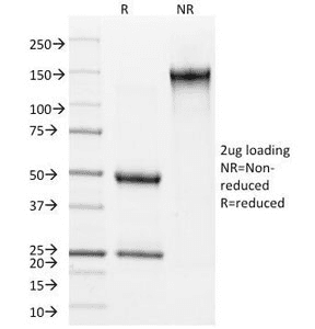 IVL / Involucrin Antibody (clone SY5)