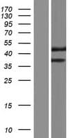 TMEM236 Protein (Over-Expression Lysate Myc-DDK (Flag))