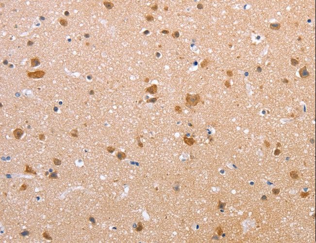 IHC-plus™ CLDN10 / Claudin 10 Antibody