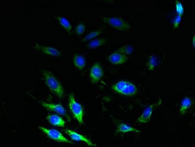 Polyclonal Rabbit anti-Human SSR3 / TRAP-Gamma Antibody (IHC, WB)