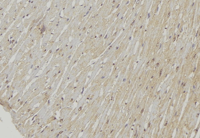 Polyclonal Rabbit anti-Human UCP2 Antibody (IHC, IF, WB)